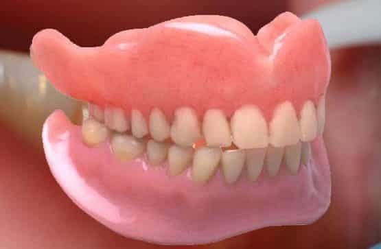 Dentures Treatment in Singanallur