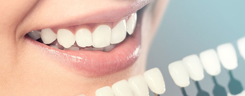 Cosmetic Dental Treatments in Coimbatore