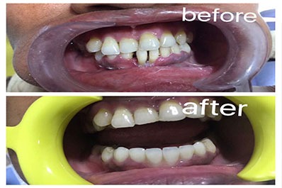 dentla appoinment in coimbatore