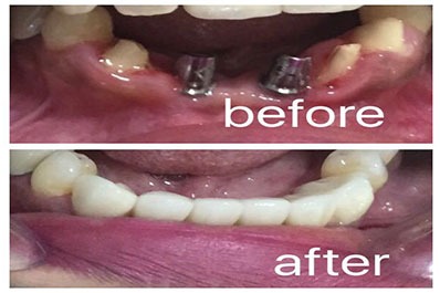 best dental care in coimbatore